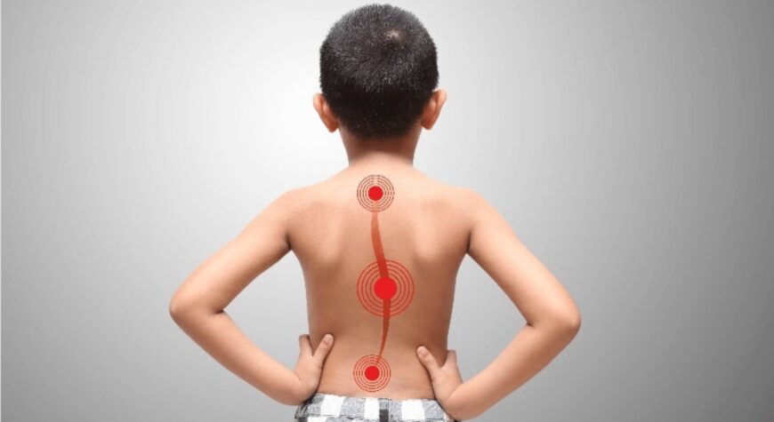 scoliosis-treatment-noida-lajpat-gurugram-chandigarh.jpg - Synchrony Chiropractic & Sports Physiotherapy - Chiropractor Near Me | Delhi | Noida | Chandigarh Chiropractor treating scoliosis with posture correction at Synchrony Health clinic
