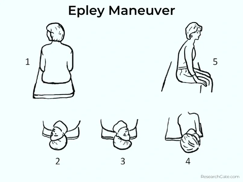 Illustration showing five steps of the Epley maneuver for treating vertigo at home.